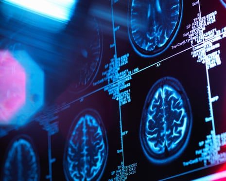 Adolescence lasts into 30s - new study shows four pivotal ages for your brain